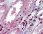 MPDZ antibody - middle region